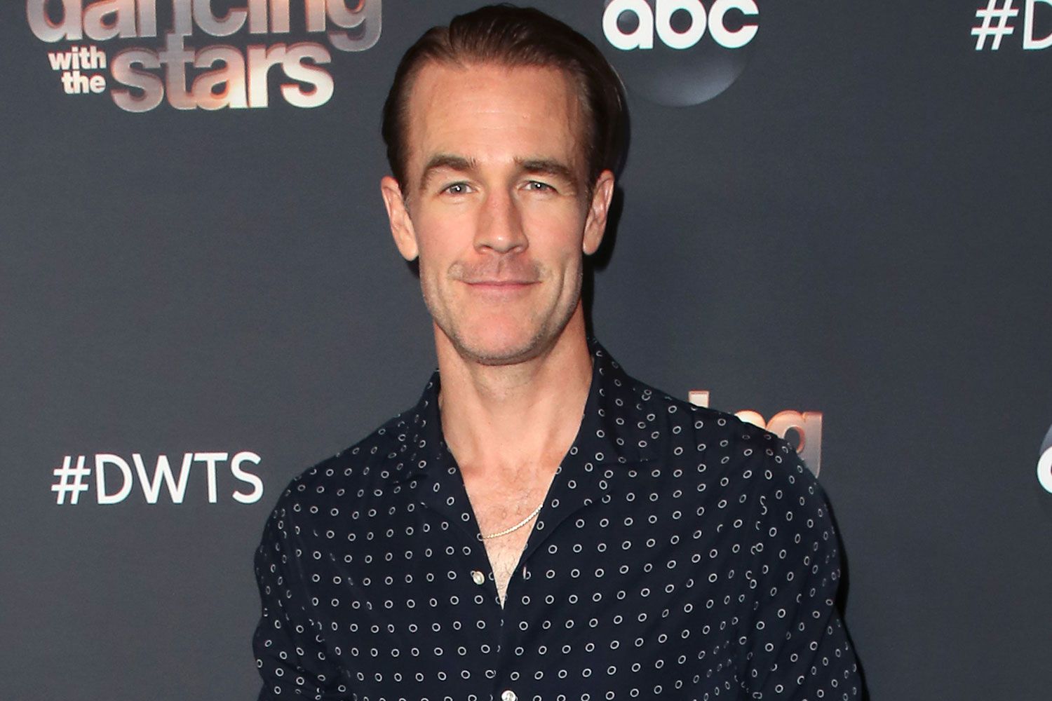 james-van-der-beek-buka-suara-mengenai-diagnosis-kanker-kolorektal